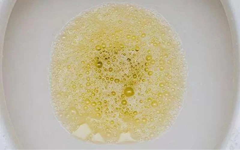 nước tiểu sủi bọt